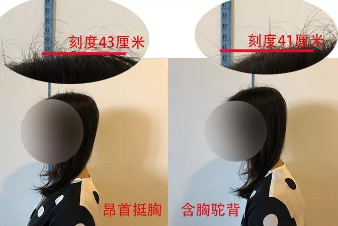你可能也變得脖子前傾、含胸駝背了